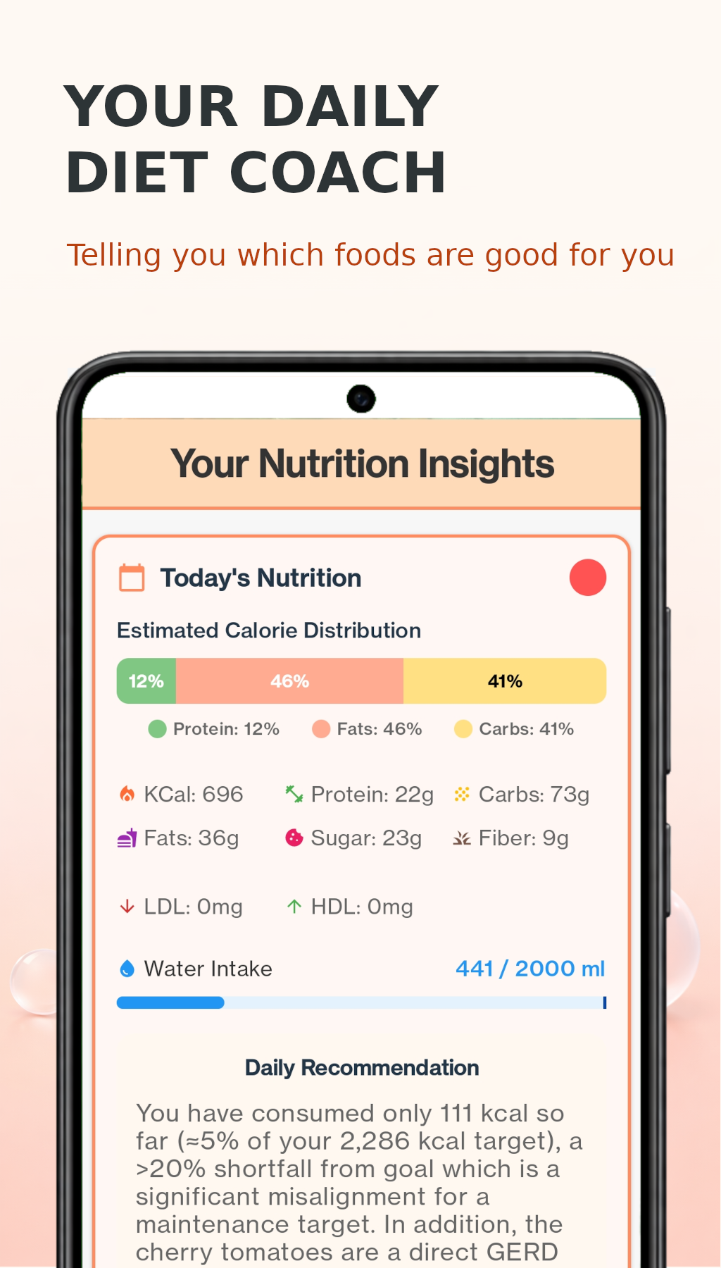 DietVox daily nutrition insights dashboard with calorie and macro tracking